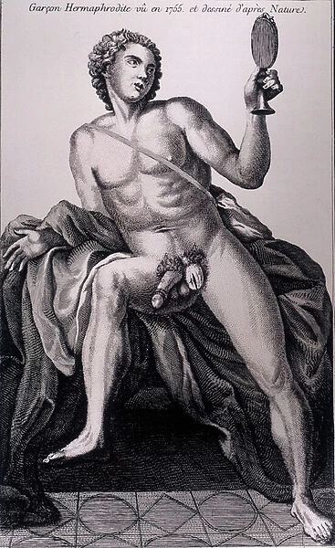 Hermaphrodite boy seen in 1755 and drawn from nature