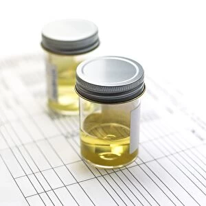 Urine samples F007 / 8175