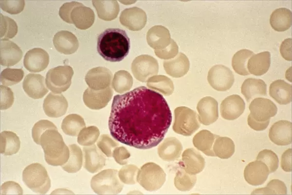 Myeloblast blood cell, light micrograph