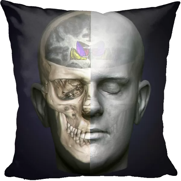 Human head, MRI and 3D CT scans C016  /  6398