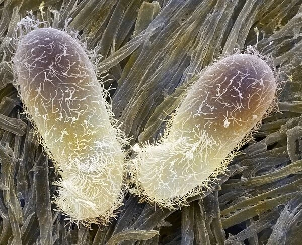 Chilodonella ciliate protozoan, SEM