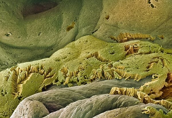 Gall bladder surface, SEM