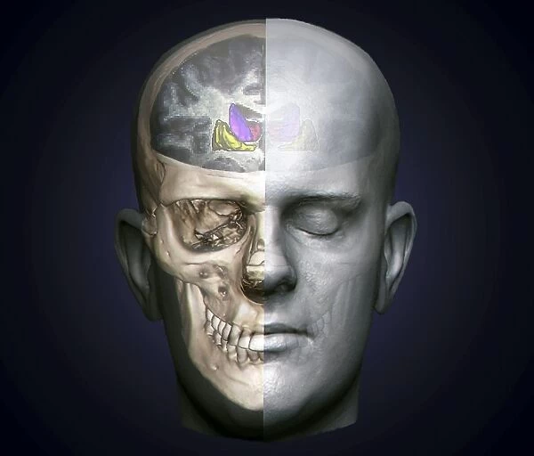 Human head, MRI and 3D CT scans C016  /  6398