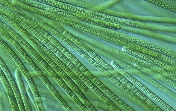 Oscillatoria, light microscope view of cyanobacteria