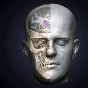 Human head, MRI and 3D CT scans C016 / 6398