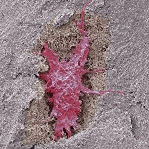 Osteocyte bone cell, SEM C016 / 9026